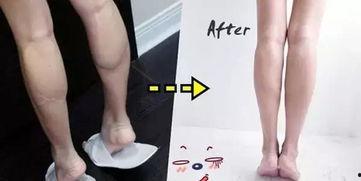 明星打瘦腿针,揭秘打瘦腿针的神奇效果